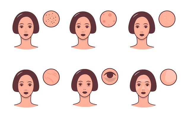 Problem tespit edilir