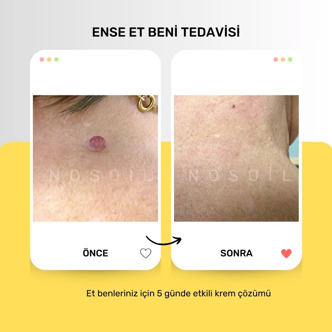Instagram shop